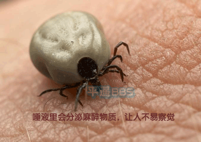 衛(wèi)生部發(fā)布“蜱的特點及預防控制知識”