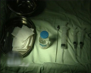 部分消費者美容整形注射奧美定引發(fā)癌癥