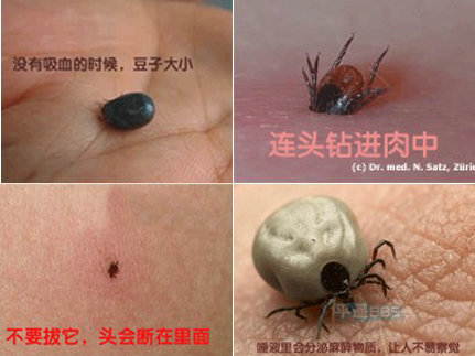 衛(wèi)生部發(fā)布“蜱的特點(diǎn)及預(yù)防控制知識(shí)”