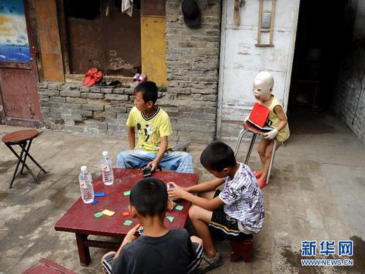 備受網友關注的“面具娃娃”回家休養(yǎng)