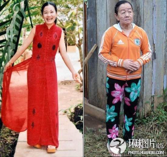 難以置信的罕見怪?。和浐粑?靜電過敏 聽鬧鐘響心臟停跳