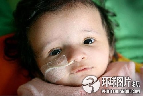 難以置信的罕見(jiàn)怪?。和浐粑?靜電過(guò)敏 聽(tīng)鬧鐘響心臟停跳