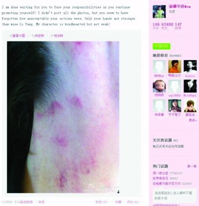 李陽再次家暴！妻子曝光照片