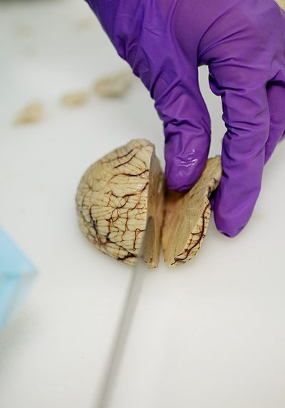 揭秘大腦解剖全過(guò)程