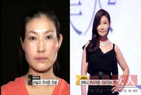 丑女變靚妹！韓國整容節(jié)目爆紅