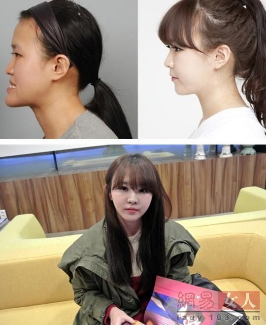 丑女變靚妹！韓國整容節(jié)目爆紅