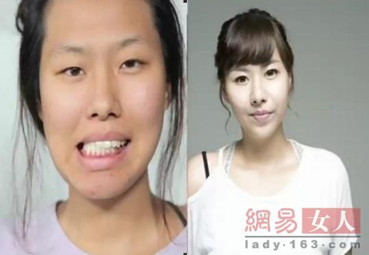 丑女變靚妹！韓國整容節(jié)目爆紅
