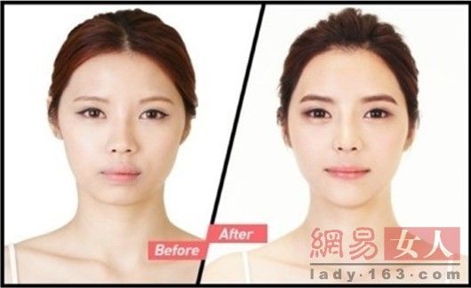 丑女變靚妹！韓國整容節(jié)目爆紅