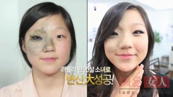 丑女變靚妹！韓國(guó)整容節(jié)目爆紅