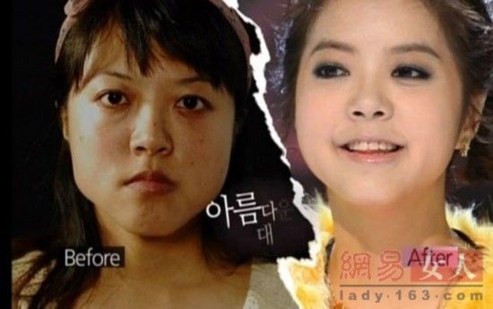 丑女變靚妹！韓國(guó)整容節(jié)目爆紅