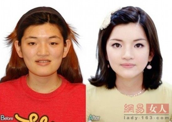 丑女變靚妹！韓國整容節(jié)目爆紅