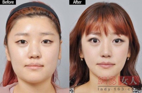 丑女變靚妹！韓國整容節(jié)目爆紅