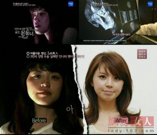 丑女變靚妹！韓國整容節(jié)目爆紅