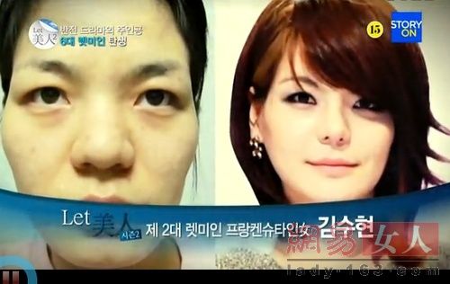丑女變靚妹！韓國整容節(jié)目爆紅