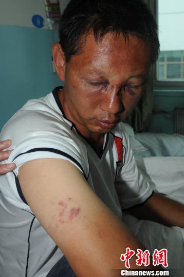 西寧警察處警被城管打傷槍險被搶 當?shù)卣{查(圖)