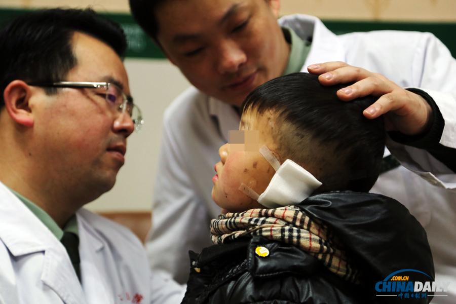 6歲男童慘遭嬸嬸割耳續(xù)：有醫(yī)院免費(fèi)為他造左耳