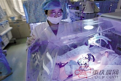 23周！重慶第一早產(chǎn)兒“筷子寶寶”正在頑強(qiáng)存活著