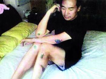 孫紅雷小沈陽(yáng)打架高峰斗歐 揭娛樂(lè)圈打人事件(圖)