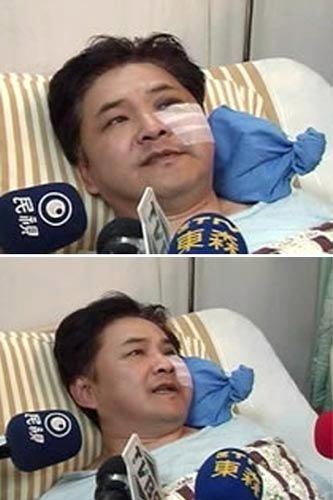 孫紅雷小沈陽(yáng)打架高峰斗歐 揭?jiàn)蕵?lè)圈打人事件(圖)