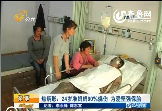 濰坊24歲準(zhǔn)媽媽全身90%燒傷 丈夫婆婆離世為愛堅強保胎