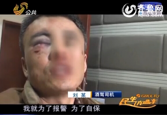 濟(jì)南：酒后斗毆被打滿臉傷痕 男子酒駕求救警察