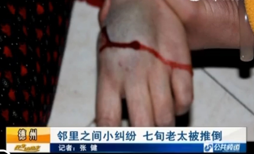 德州：因小孩動(dòng)靜大鄰居鬧糾紛 七旬老太被推倒摔傷