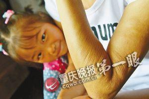 妙齡女自幼患病面容似老太全身皮膚松弛(圖)