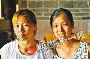 妙齡女自幼患病面容似老太全身皮膚松弛(圖)