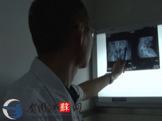 江蘇淮安女?huà)塍w內(nèi)取出4根縫衣針 或?yàn)槿藶樵?/></font></p>

<p align=
