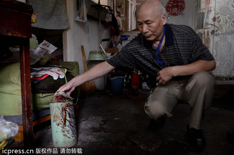北京一老太因養(yǎng)狗起沖突 九旬奶奶被咬受傷