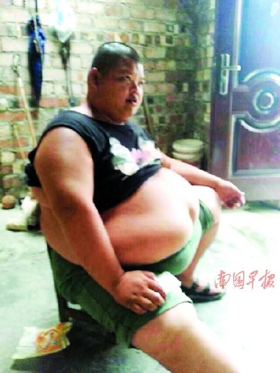 男子單純性肥胖320余斤 曾為愛(ài)減肥30斤(圖)