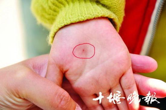 十堰兩歲男童遭老師用針扎手 老師稱體驗(yàn)式教學(xué)(圖)