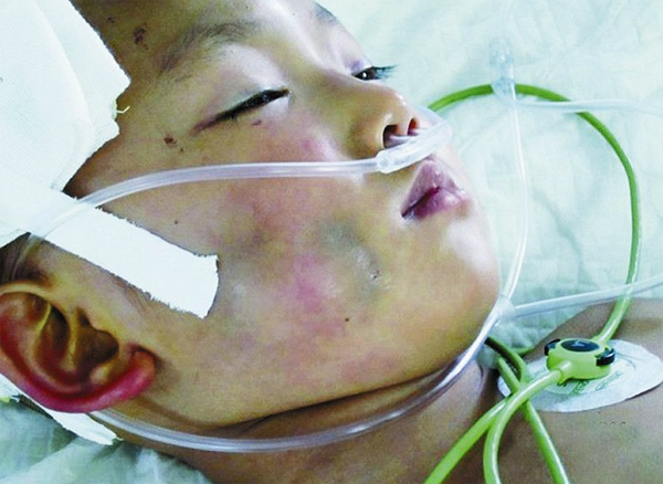 3歲男童被母親打至昏迷不醒 已開顱尚未脫離生命危險(xiǎn)