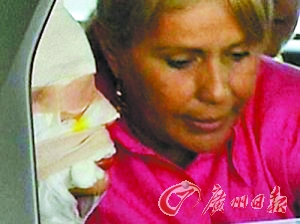 哥倫比亞小姐奪冠熱門(mén)選手被潑鹽酸嚴(yán)重毀容