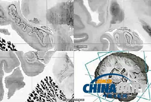 科學(xué)家繪制出3D人腦高清模型 或可助治神經(jīng)疾病