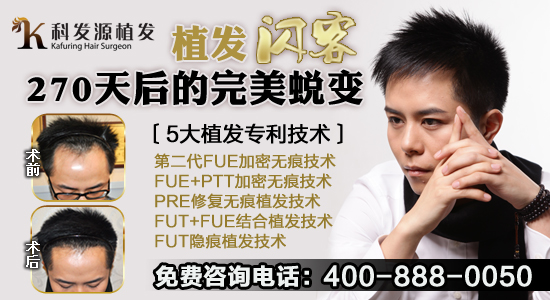 脫發(fā)的原因有哪些？科發(fā)源揭秘脫發(fā)三大原因