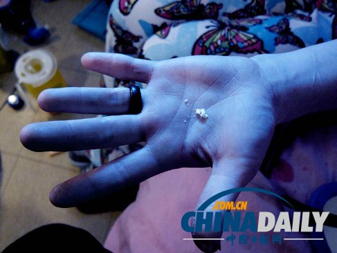 美麗蛻變！實(shí)拍吸毒女孩的戒毒歷程