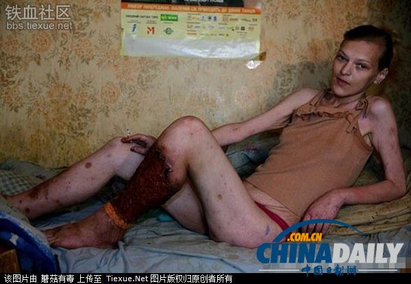 美麗蛻變！實(shí)拍吸毒女孩的戒毒歷程