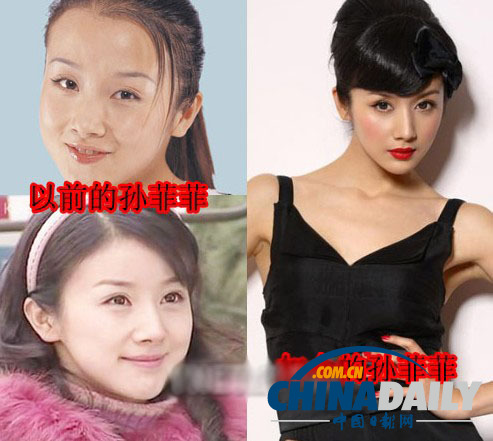 柳巖李小璐楊冪　女星整容前驚人對(duì)比照