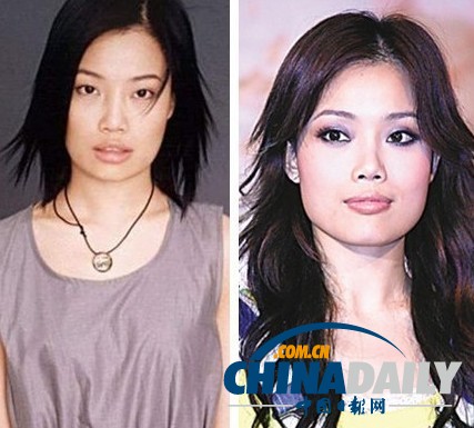 柳巖李小璐楊冪　女星整容前驚人對(duì)比照