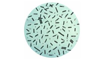 肉毒桿菌簡(jiǎn)介