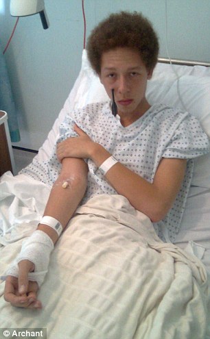 十字弓箭離奇自動發(fā)射 英17歲男孩面部受傷險(xiǎn)些沒命