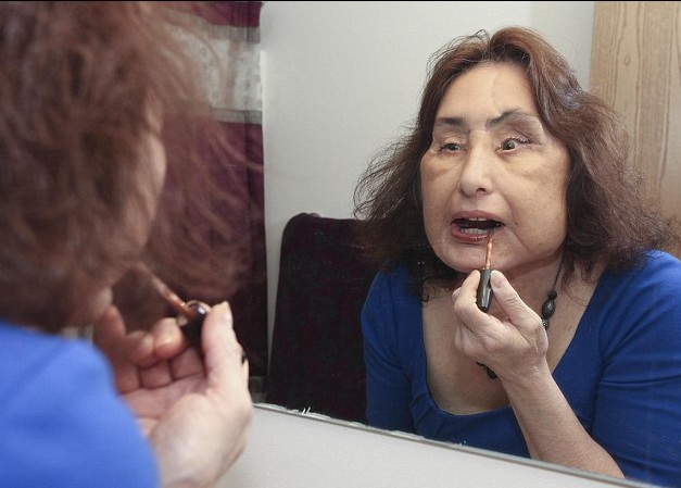 美國(guó)“換臉女”的人生奮斗 雖與兇手丈夫離婚但愛心不變