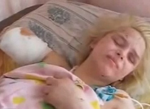 烏克蘭慘遭輪奸焚燒18歲少女傷重不治不幸離世