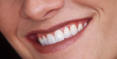 英科學(xué)家用牙齦細胞培育出新牙 擺脫假牙有希望