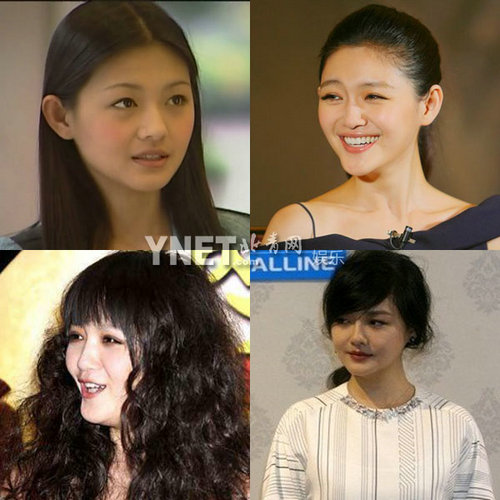 明星整容慘面癱 大S李小璐越發(fā)詭異