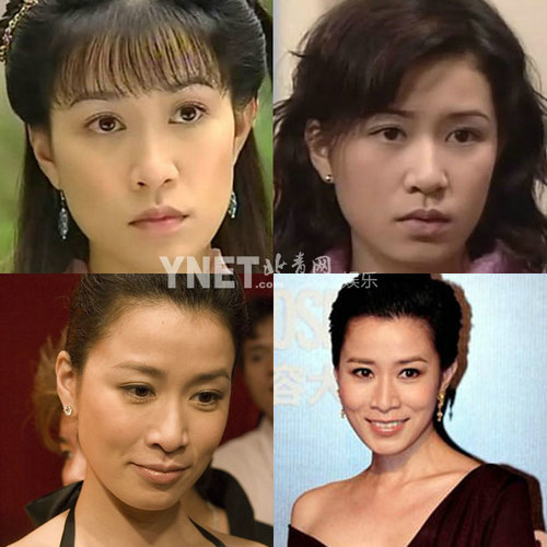 明星整容慘面癱 大S李小璐越發(fā)詭異