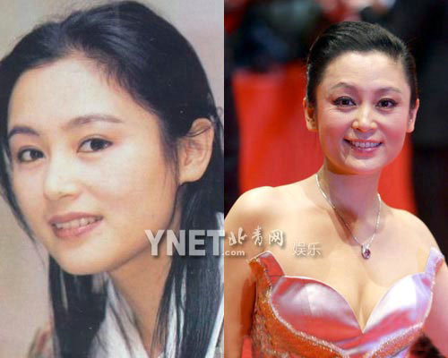 明星整容慘面癱 大S李小璐越發(fā)詭異