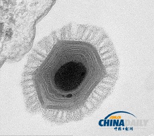 法國科學(xué)家發(fā)現(xiàn)前所未見的巨型病毒 或來自火星