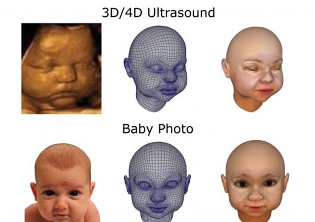 3D打印帶你見(jiàn)未出生胎兒！體位表情皮膚性別皆可見(jiàn)